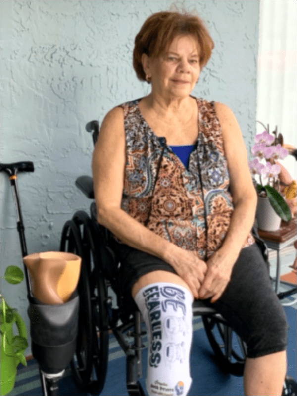 Mom amputee community btka